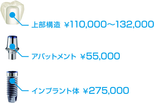 インプラントの料金